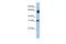 Dehydrogenase/Reductase 2 antibody, GTX47054, GeneTex, Western Blot image 