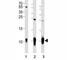 S100 Calcium Binding Protein B antibody, F49008-0.4ML, NSJ Bioreagents, Immunohistochemistry paraffin image 