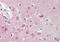 Origin recognition complex subunit 3 antibody, orb18313, Biorbyt, Immunohistochemistry paraffin image 