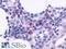 C-X-C chemokine receptor type 5 antibody, LS-A1385, Lifespan Biosciences, Immunohistochemistry frozen image 