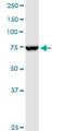 NADH:Ubiquinone Oxidoreductase Core Subunit S1 antibody, H00004719-D01P, Novus Biologicals, Western Blot image 