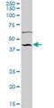 Nucleoporin 43 antibody, H00348995-B01P, Novus Biologicals, Western Blot image 