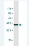 SAM And SH3 Domain Containing 1 antibody, H00023328-M02, Novus Biologicals, Western Blot image 