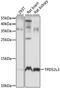 TPD52 Like 3 antibody, LS-C750513, Lifespan Biosciences, Western Blot image 