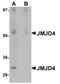 Jumonji Domain Containing 4 antibody, PA5-20805, Invitrogen Antibodies, Western Blot image 