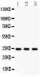 Caspase 7 antibody, LS-C357560, Lifespan Biosciences, Western Blot image 