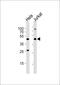 ADH antibody, M01660, Boster Biological Technology, Western Blot image 