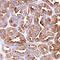 Heat Shock Protein Family B (Small) Member 1 antibody, MAB1580, Novus Biologicals, Immunohistochemistry paraffin image 