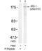 Insulin Receptor Substrate 1 antibody, GTX79036, GeneTex, Western Blot image 