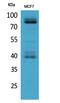 Interleukin 1 Receptor Type 1 antibody, STJ96628, St John