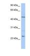 Transmembrane And Coiled-Coil Domains 1 antibody, NBP1-59980, Novus Biologicals, Western Blot image 