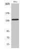 Potassium Calcium-Activated Channel Subfamily M Alpha 1 antibody, STJ94031, St John