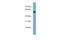 Alanine--Glyoxylate Aminotransferase 2 antibody, A07716, Boster Biological Technology, Western Blot image 