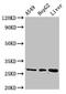 Proteasome Subunit Alpha 5 antibody, CSB-PA018870LA01HU, Cusabio, Western Blot image 