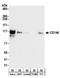 MCAM antibody, A304-335A, Bethyl Labs, Western Blot image 