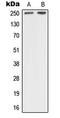 Neurofibromin 1 antibody, MBS821021, MyBioSource, Western Blot image 