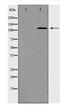 Telomerase Reverse Transcriptase antibody, TA348918, Origene, Western Blot image 