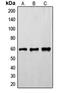 SLK antibody, GTX32185, GeneTex, Western Blot image 