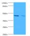 Hemoglobin Subunit Alpha 2 antibody, MBS1489797, MyBioSource, Western Blot image 