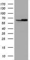 Heat Shock Protein Family D (Hsp60) Member 1 antibody, TA800774BM, Origene, Western Blot image 