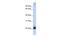 Integrin Subunit Beta 3 Binding Protein antibody, PA5-44255, Invitrogen Antibodies, Western Blot image 