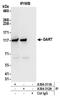 Phosphoribosylglycinamide Formyltransferase, Phosphoribosylglycinamide Synthetase, Phosphoribosylaminoimidazole Synthetase antibody, A304-311A, Bethyl Labs, Immunoprecipitation image 