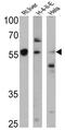 Cytochrome P450 4A10 antibody, GTX79175, GeneTex, Western Blot image 