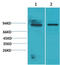 Signal Transducer And Activator Of Transcription 5A antibody, STJ97484, St John