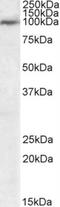 Ubiquitin Specific Peptidase 20 antibody, NB100-1260, Novus Biologicals, Western Blot image 