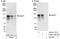 Arf-GAP with SH3 domain, ANK repeat and PH domain-containing protein 1 antibody, A302-117A, Bethyl Labs, Western Blot image 