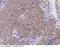 TTK Protein Kinase antibody, 101015-T10, Sino Biological, Immunohistochemistry paraffin image 