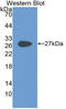 Glycoprotein 2 antibody, LS-C314994, Lifespan Biosciences, Western Blot image 