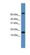 CST9 antibody, NBP1-79739, Novus Biologicals, Western Blot image 