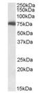 USH1 Protein Network Component Harmonin antibody, orb18843, Biorbyt, Western Blot image 