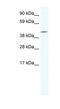 Iroquois Homeobox 6 antibody, MBS536483, MyBioSource, Western Blot image 