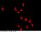 RAD18 E3 Ubiquitin Protein Ligase antibody, 101047-T10, Sino Biological, Immunohistochemistry paraffin image 