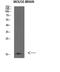 Fatty Acid Binding Protein 7 antibody, STJ98678, St John
