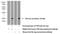 Lymphotoxin Alpha antibody, 13111-1-AP, Proteintech Group, Western Blot image 