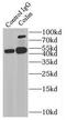 Coilin antibody, FNab01833, FineTest, Immunoprecipitation image 