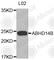 Abhydrolase Domain Containing 14B antibody, A3532, ABclonal Technology, Western Blot image 