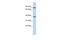 DEAH-Box Helicase 35 antibody, A12712, Boster Biological Technology, Western Blot image 