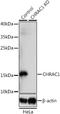 Chromatin Accessibility Complex Subunit 1 antibody, LS-C749876, Lifespan Biosciences, Western Blot image 