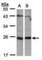 Inosine Triphosphatase antibody, GTX106635, GeneTex, Western Blot image 