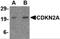 Cyclin-dependent kinase inhibitor 2A, isoforms 1/2/3 antibody, A00016-1, Boster Biological Technology, Western Blot image 