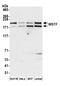 Bromodomain Adjacent To Zinc Finger Domain 1B antibody, A300-446A, Bethyl Labs, Western Blot image 