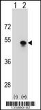 Small Nuclear RNA Activating Complex Polypeptide 1 antibody, 58-484, ProSci, Western Blot image 