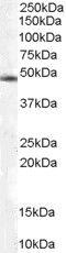 COP9 Signalosome Subunit 2 antibody, PA5-18161, Invitrogen Antibodies, Western Blot image 