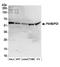 Prolyl 4-Hydroxylase Subunit Beta antibody, A304-790A, Bethyl Labs, Western Blot image 