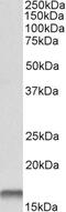 Cystatin B antibody, GTX15970, GeneTex, Western Blot image 