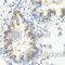 Sonic Hedgehog Signaling Molecule antibody, A7726, ABclonal Technology, Immunohistochemistry paraffin image 